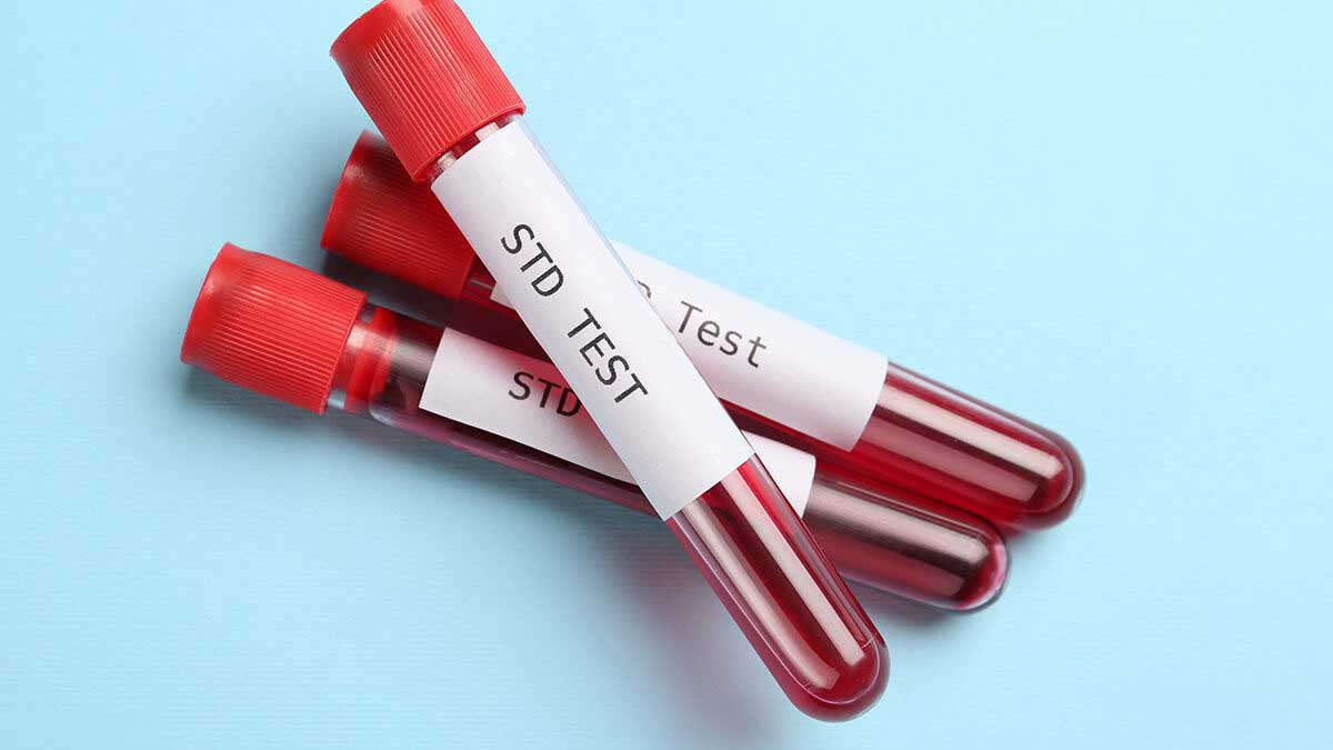 STI testing misconceptions