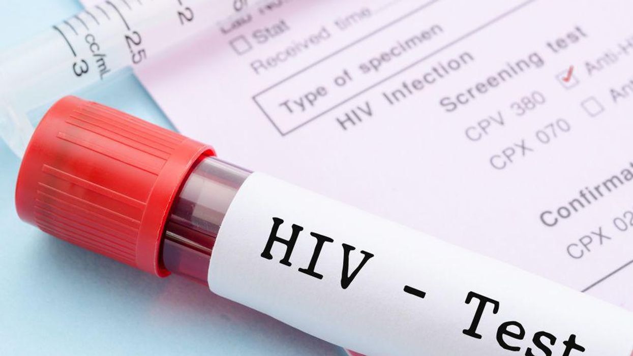 HIV transmission