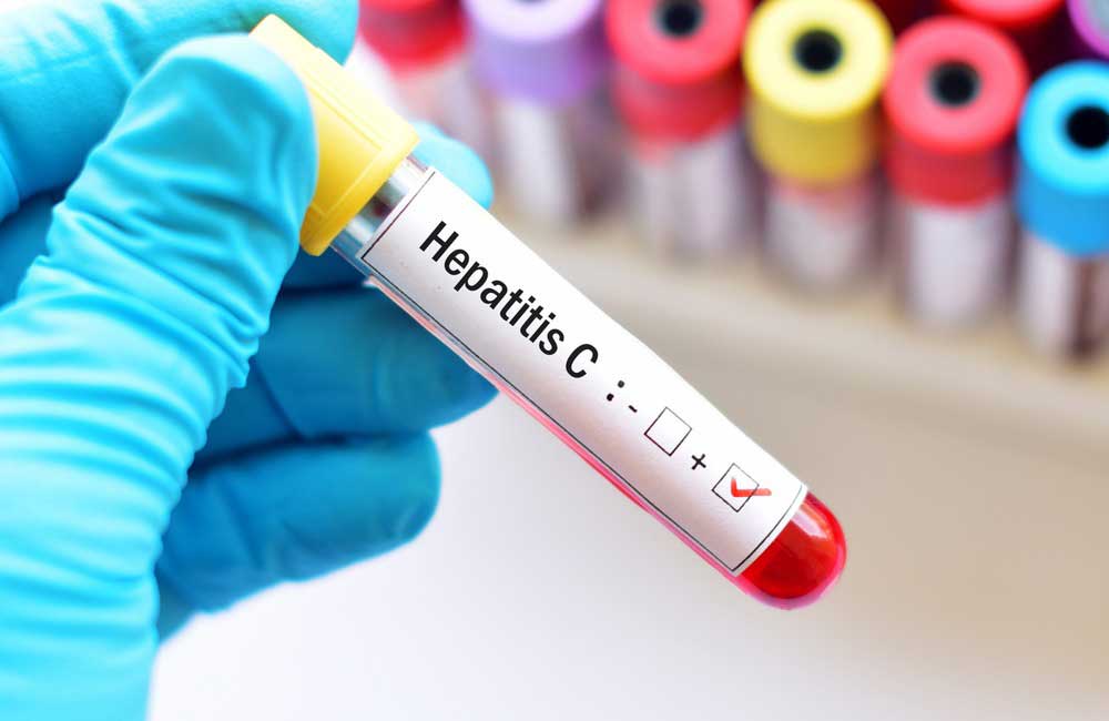 Hepatitis C transmission prevention