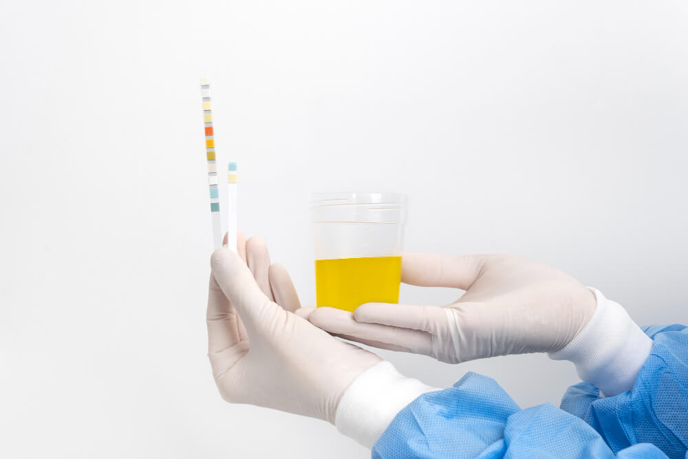 Urine Tests