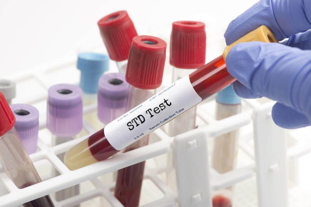STD Testing and Preventing AIDS Progression with Specialty Care