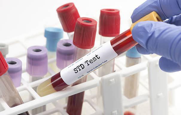 The Importance of STD Testing 